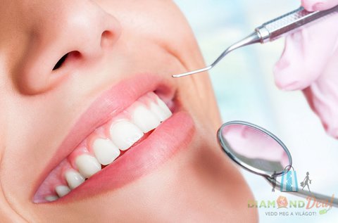 Egészséges fogak, vakító mosoly Airflow kezeléssel