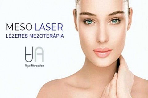 MesoILaser mezoterápiás arc-, toka és nyakkezelés