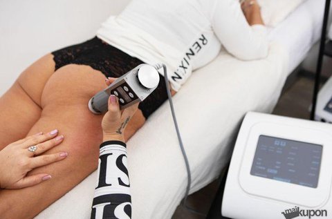 1 alkalom feszesítő lökéshullám terápia