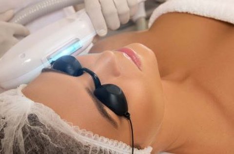 Bőrfiatalítás, rozácea és pigmentálódás kezelés