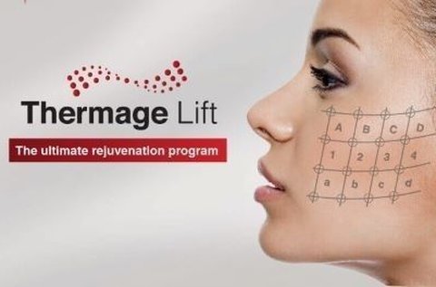 Thermage IV. mátrixpontos RF ránckezelés