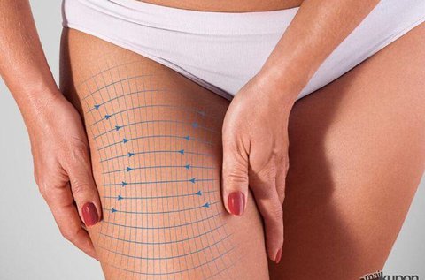 3 alkalmas zsírbontó és vízhajtó kezelés combról