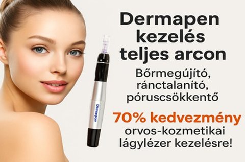 Bőrmegújítás Dermapen kezeléssel