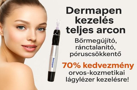 Dermapen kezelés 4D hyaluronsavakkal