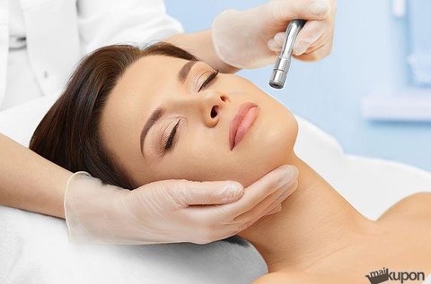 2 alkalom bőrmegújító mikrodermabrázió