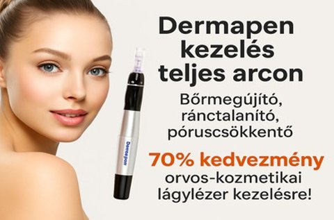 Dermapen kezelés 4D hyaluronsavakkal