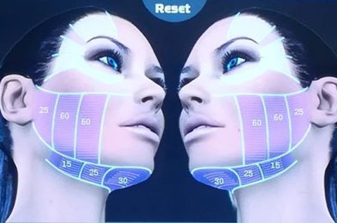 HIFU arcfiatalító és ránctalanító kezelés