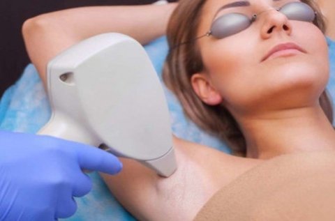 5 alkalmas valódi dióda lézeres szőrtelenítő bérlet