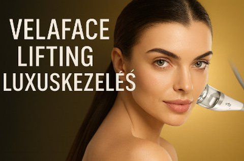 Velaface luxus lifting rádiófrekvenciával
