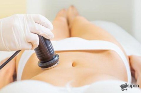 3 alkalmas kavitációs, ultrahangos zsírbontás