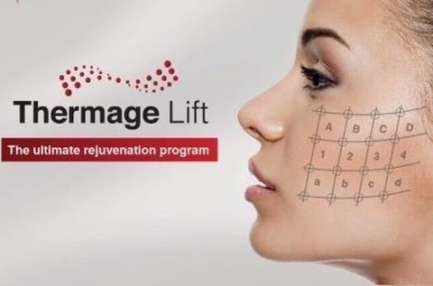 Thermage IV. mátrixpontos RF ránckezelés