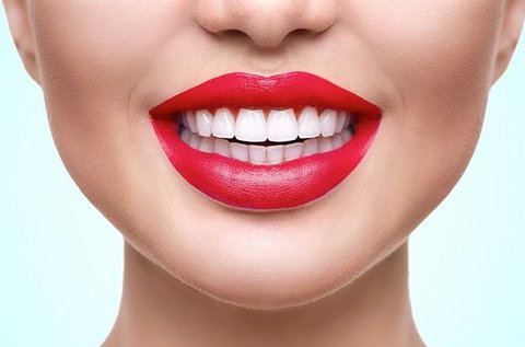 Peroxidmentes fogfehérítés a hófehér mosolyért