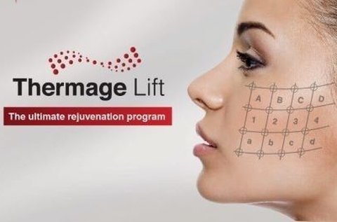 Thermage IV. mátrixpontos RF ránckezelés
